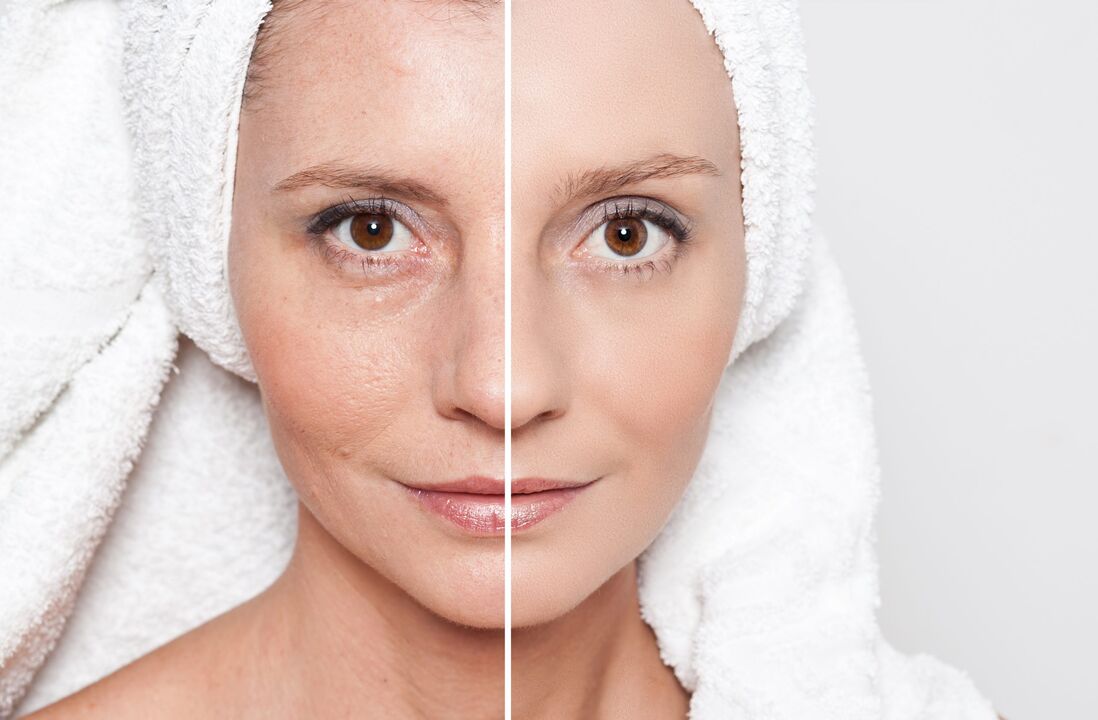 Anti-Aging-Hautbehandlungen